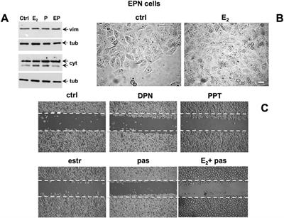 Corrigendum: Estrogens modulate somatostatin receptors expression and synergize with the somatostatin analog pasireotide in prostate cells